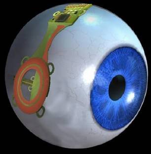 bionic_eye bionic_eye
